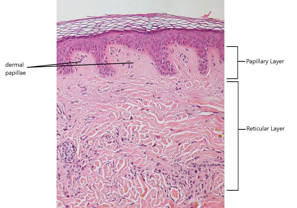 Skin as viewed under the microscope with the layers of the dermis labelled.