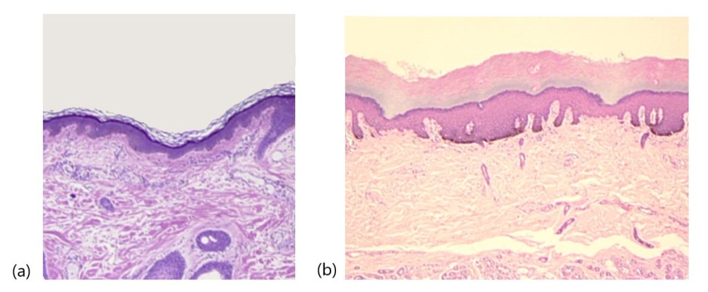 Thin and thick skin as viewed under the microscope