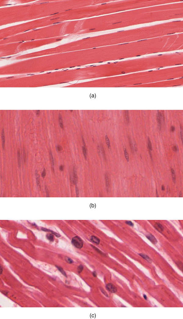 This shows three micrographs, each depicting one of the three muscle tissues. Picture A shows skeletal muscle tissue, which is dense strips of pink tissue that somewhat resemble bacon in appearance. Many small nuclei are dispersed throughout the tissues. The nuclei are flat and elongated, with multiple nuclei clustered into each cell. Picture B shows smooth muscle, which is densely packed and looks similar to skeletal muscle except that each cell only has one oval-shaped nucleus. Picture C shows cardiac muscle. Unlike skeletal and smooth muscle cells, cardiac muscle cells are not densely packed. The cardiac cells are branched, creating a large amount of space between each muscle cell.