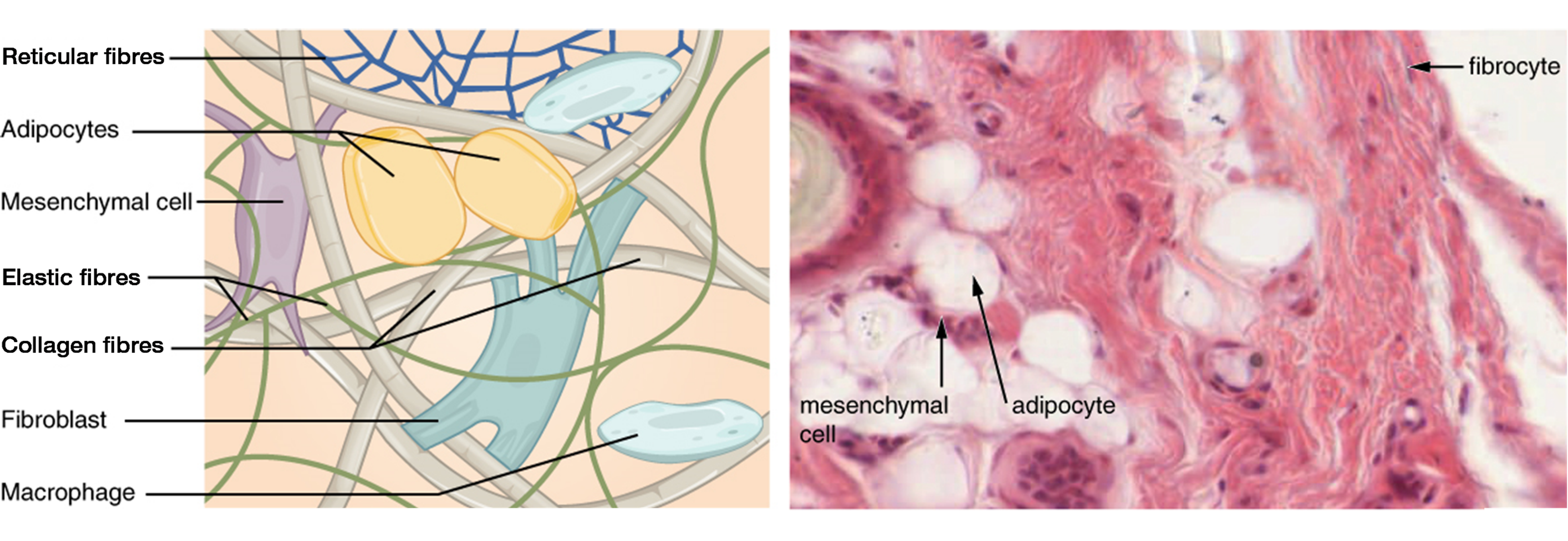 The left image shows a diagram of connective tissue. As a whole, the connective tissue appears somewhat disorganized, with fibers and cells mixed together heterogeneously. There are many open spaces between the embedded elements, suggesting that the connective tissue is somewhat loosely packed. The thickest fibers are collagen fibers; the thinner fibers are elastic fibers. Both the collagen fibers and the elastic fibers crisscross randomly throughout the tissue. In addition, a net of reticular fibers appear in the upper part of the diagram. Two yellow and oval shaped adipocytes are embedded below the reticular fiber net, with a small dark nucleus squeezed into one corner of the cell. A mesenchymal cell is next to one of the adipocytes. The cell is rectangular and has four projections stemming from each corner of the cell. The projections appear to attach to the nearby collagen fibers. A fibroblast is located at the center of the diagram. The fibroblast appears similar to the mesenchymal cell, except that it is larger and has more projections. Finally, a white macrophage is in the lower right of the diagram. The macrophage is a white, oval shaped disc with a prominent nucleus. The right diagram is a micrograph of connective tissue. The tissue is mostly stained pink, however, the thick collagen fibers crisscrossing the tissue are white. Five adipocytes also appear white, except for their cell membrane and nucleus, which stained dark. A mesenchymal cell occupies the space between two adipocytes. It stains a very deep purple, but its shape is unclear in the micrograph. A fibrocyte is also visible as an oval shaped cell with a deep purple nucleus.