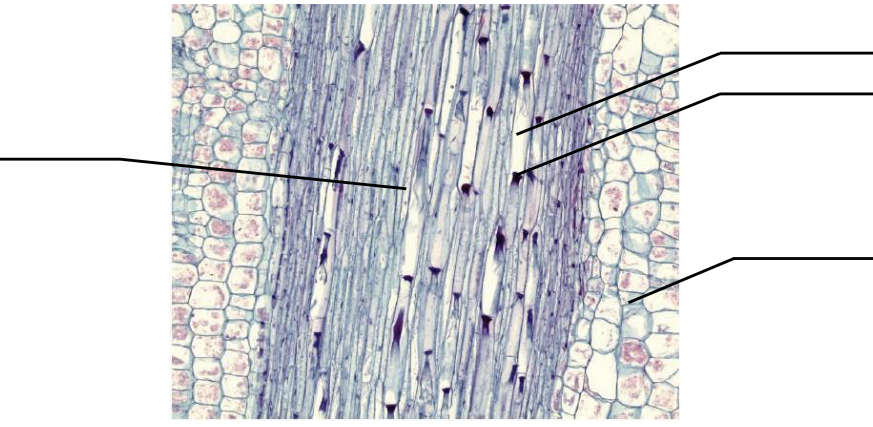 Microscopic photo with labels. Stem section has several columnar cells in the center with corn kernel-shaped cells to the left and right.