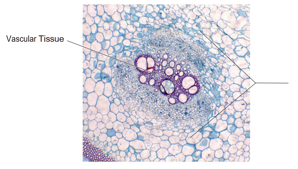 A cluster of large bulbous cells dyed purple with much smaller cells surrounding them.