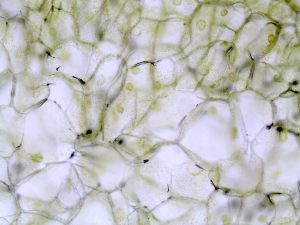 A cluster of cells with a noticeable green hue.