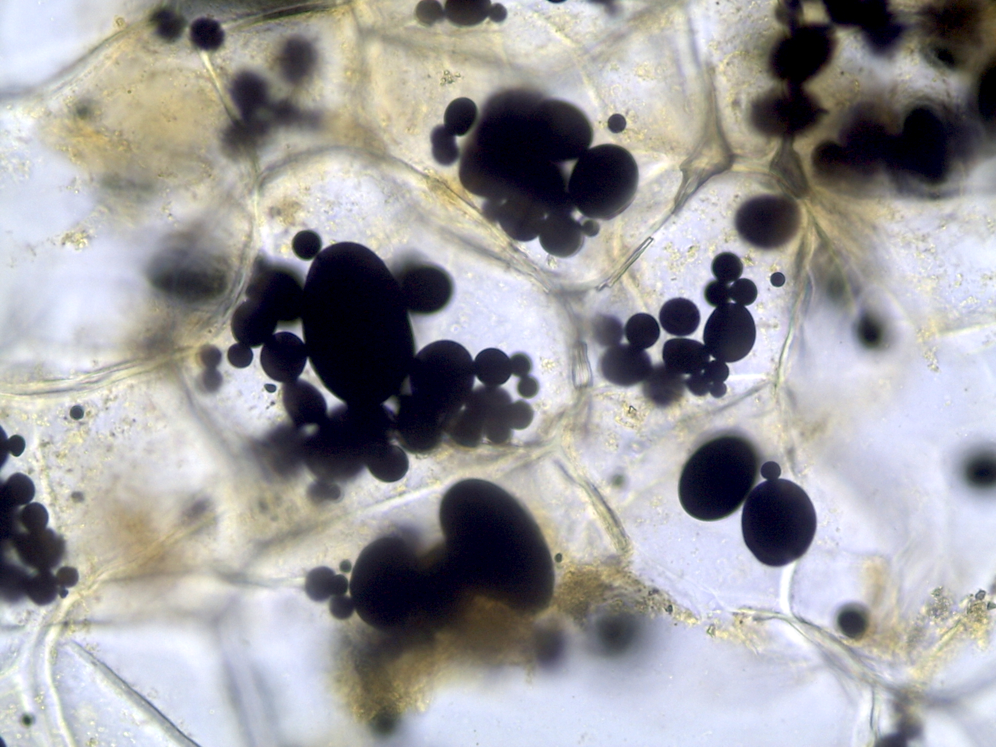 Closeup photo of cells with many dark blobs within them (amyloplasts).