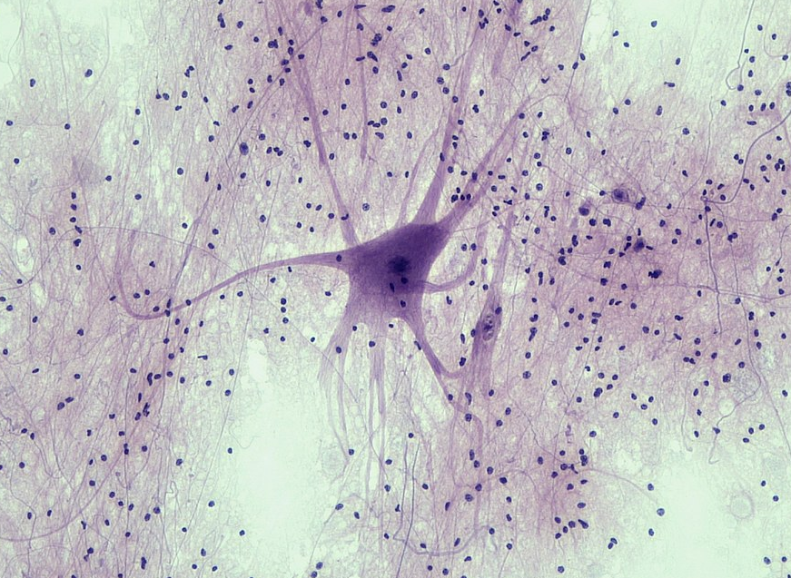 Microscopic photo of a spinal cord motor neuron.