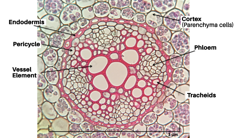 Histology slide of Ranunculus root, with sections labeled. A circular collection of cells with several distinct sections. The large circles in the center are vessels, smaller circles are tracheids, clusters are plhloem, and exterior cells of the center are the endodermis. Outside that is the Cortex cells.