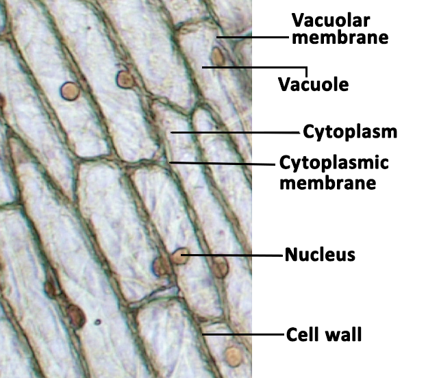 A closeup photo of columnar onion cells, labeled. The large circle is the nucleus, the outer perimeter is the cell wall, and within are the vacuolar and cytoplasmic membranes, which house the vacuole and cytoplasm.