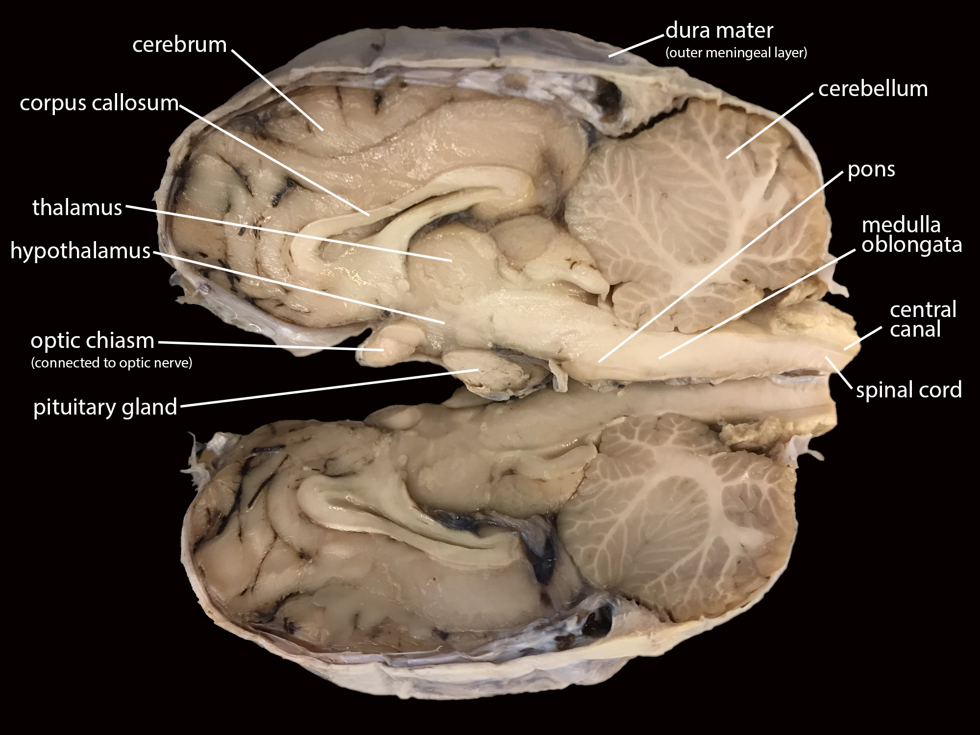 Photo of a sheep brain, bisected and labeled.