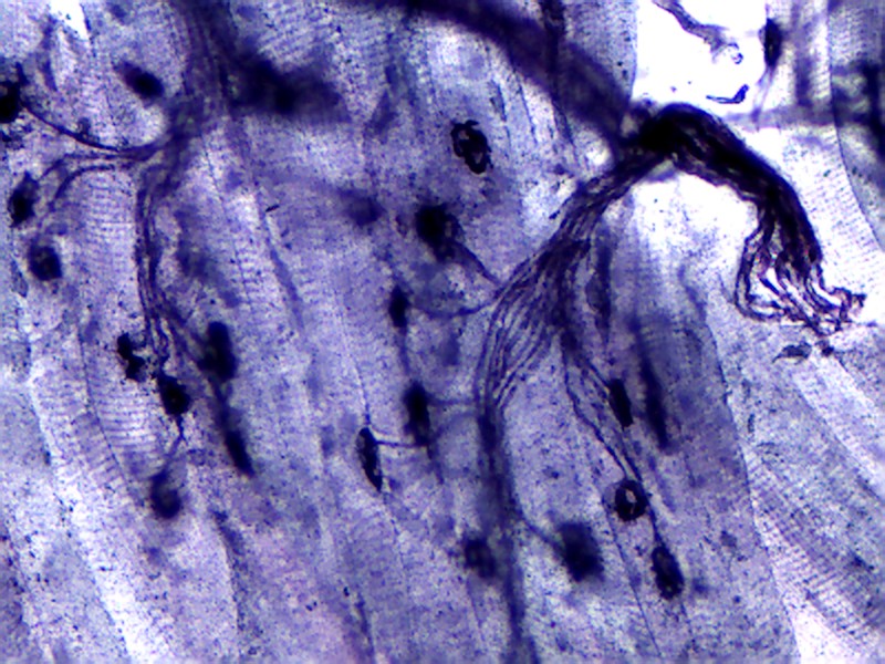 Microscopic view of neuromuscular junctions.