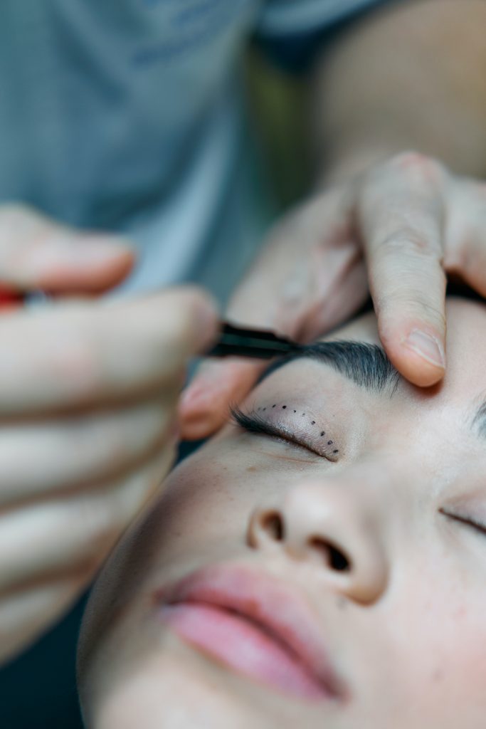 A doctor uses a marker to outline a person's eyelids for plastic surgery.