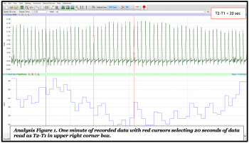 Introduction to Data Acquisition in Human Physiology – A Mixed Course ...