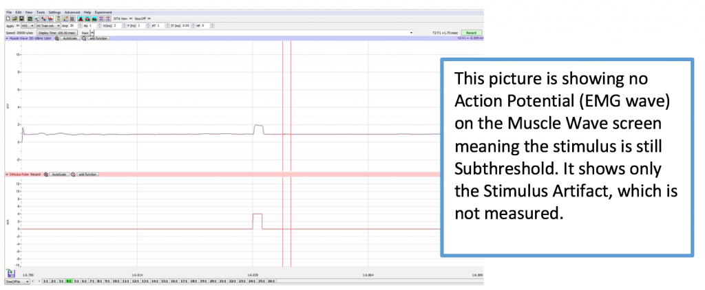 This image shows no Action Potential (EMG Wave) on the Muscle Wave screen meaning the stimulus is still subthreshold.