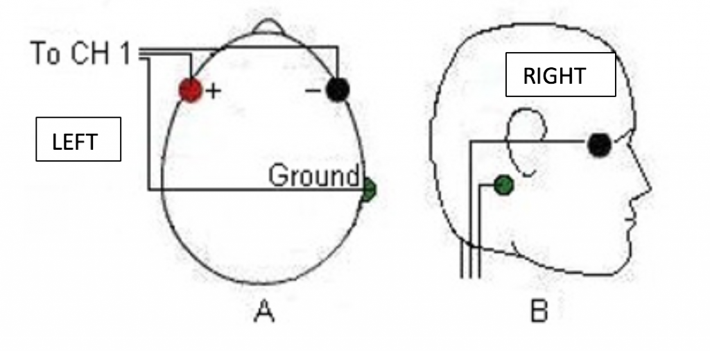 Detection of eye closing/opening from EOG and its application in