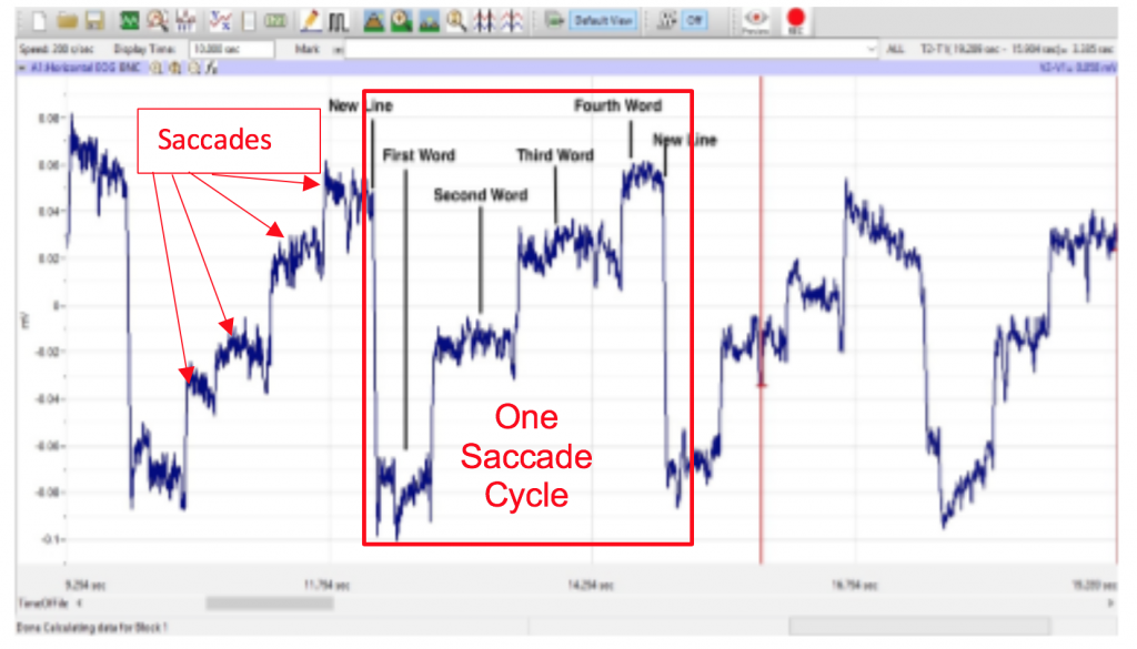 One saccade cycle is highlighted in LabScribe. A cycle contains increasing steps until reaching a height and falling again.