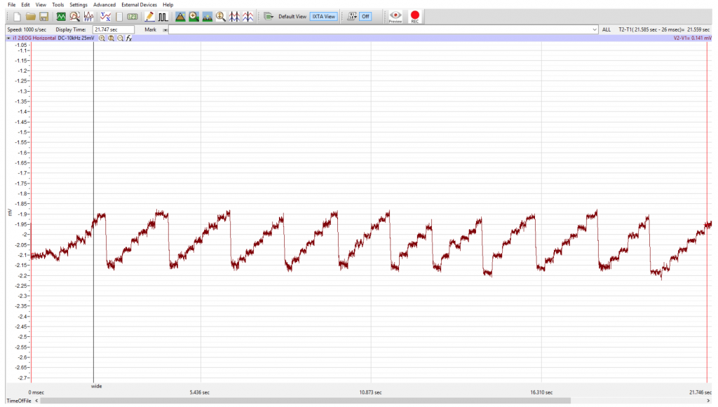 This saccadic cycle is a series of short lines rising and falling at the same height, rather than building upon one another.