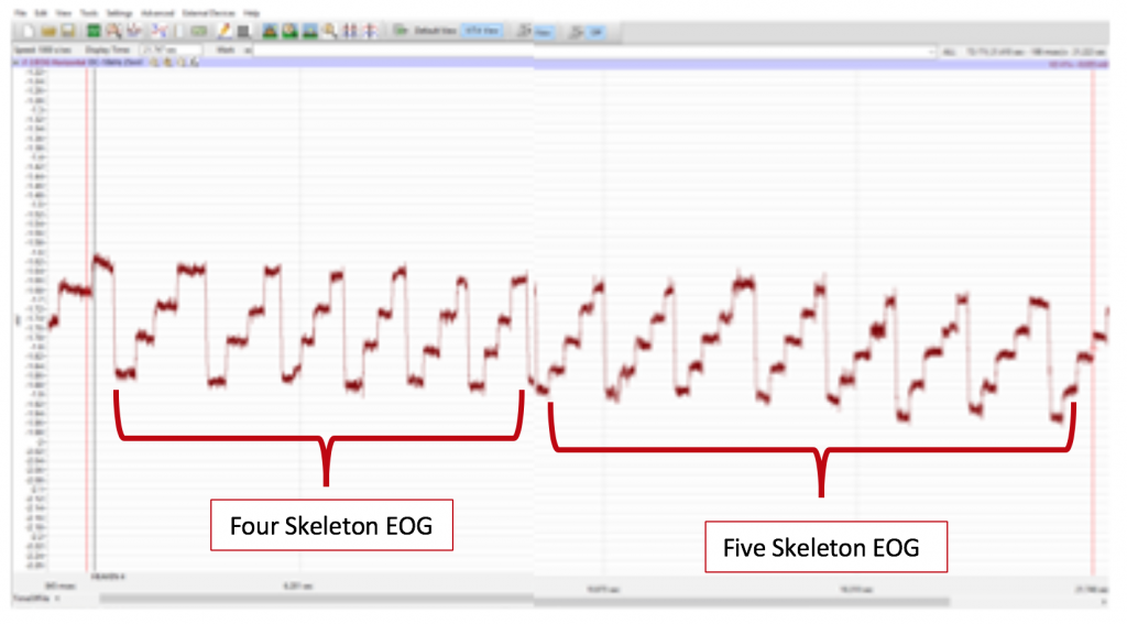 A four-skeleton EOG (a series of saccadic eye movements with 4 "steps" until each set falls) and a five skeleton EOG (a series with 5 "steps" until the falling line) are labeled.