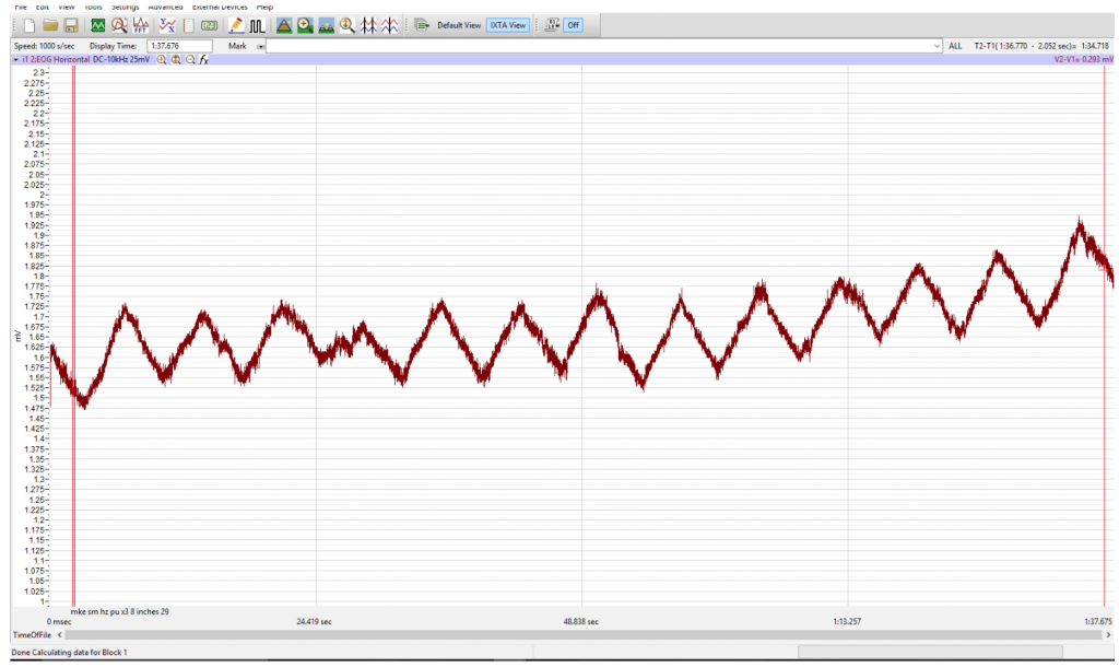 A smooth pursuit is shown, a series that is slowly gaining in height with each step.