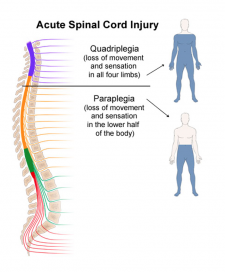 Remote Muscular Control: The Human-Human Interface – A Mixed Course ...