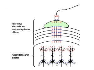 EEG figure adapted from Jackson & Bolger (2014).