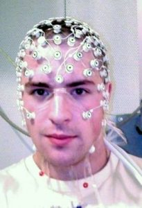 EEG electrode placement