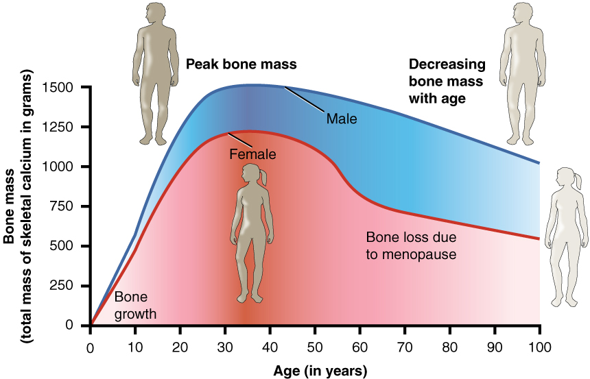 Figure showing bone density in men and women as they age. It peaks at about 30 years of age and women lose bone mass more rapidly than men.