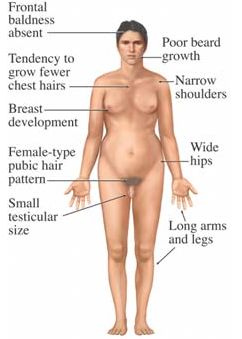 Illustration of a person with features addressed such as low body hair, breast development, wide hips, and small testis.