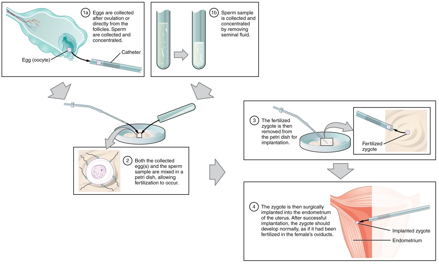 Assisted Reproductive Techniques Human Reproduction A Clinical Approach