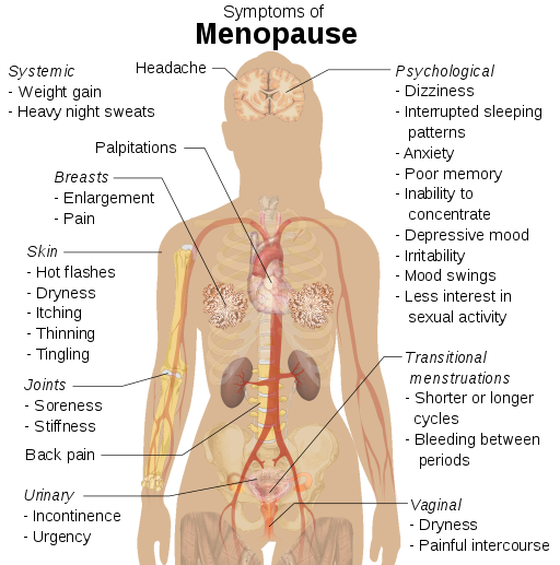 A figure labeling symptoms of menopause on a body, including systemic, psychological, and bodily issues such as weight gain, headaches, soreness, and so on.