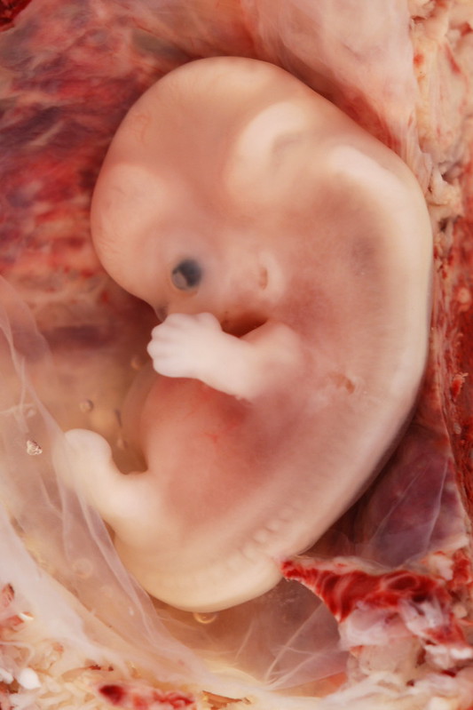 A 9-week old human embryo, mostly translucent with some identifying features, such as a spine and nubs for limbs.