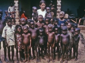 <strong>Figure 2</strong>: These children are showing the extended abdomen characteristic of kwashiorkor (Photo Courtesy Centers for Disease Control and Prevention).