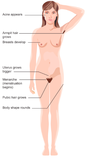 Labeled diagram of puberty physical changes in people with a vagine: acne appears, body hair grows, breasts develop, and menstruation begins.