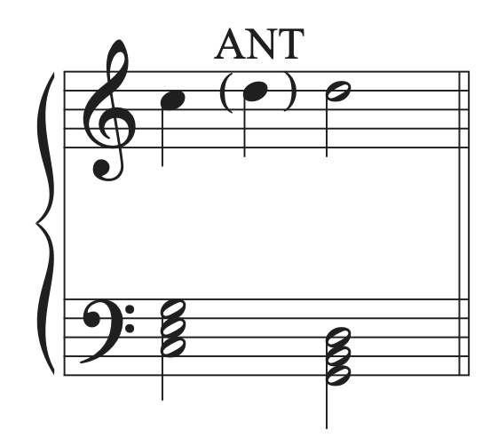 A musical example with an anticipation added and labeled.