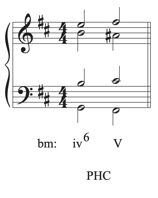 A phrygian half cadence is shown on a staff.