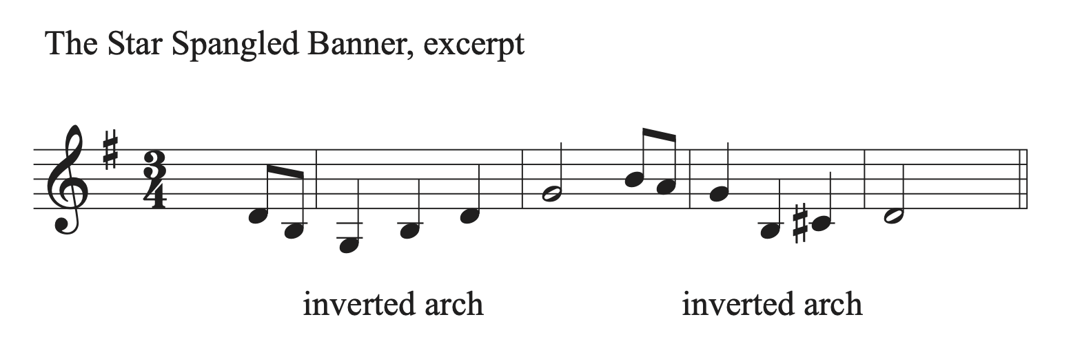 Why is MVL opening repertoire so small compared to other players? - Quora