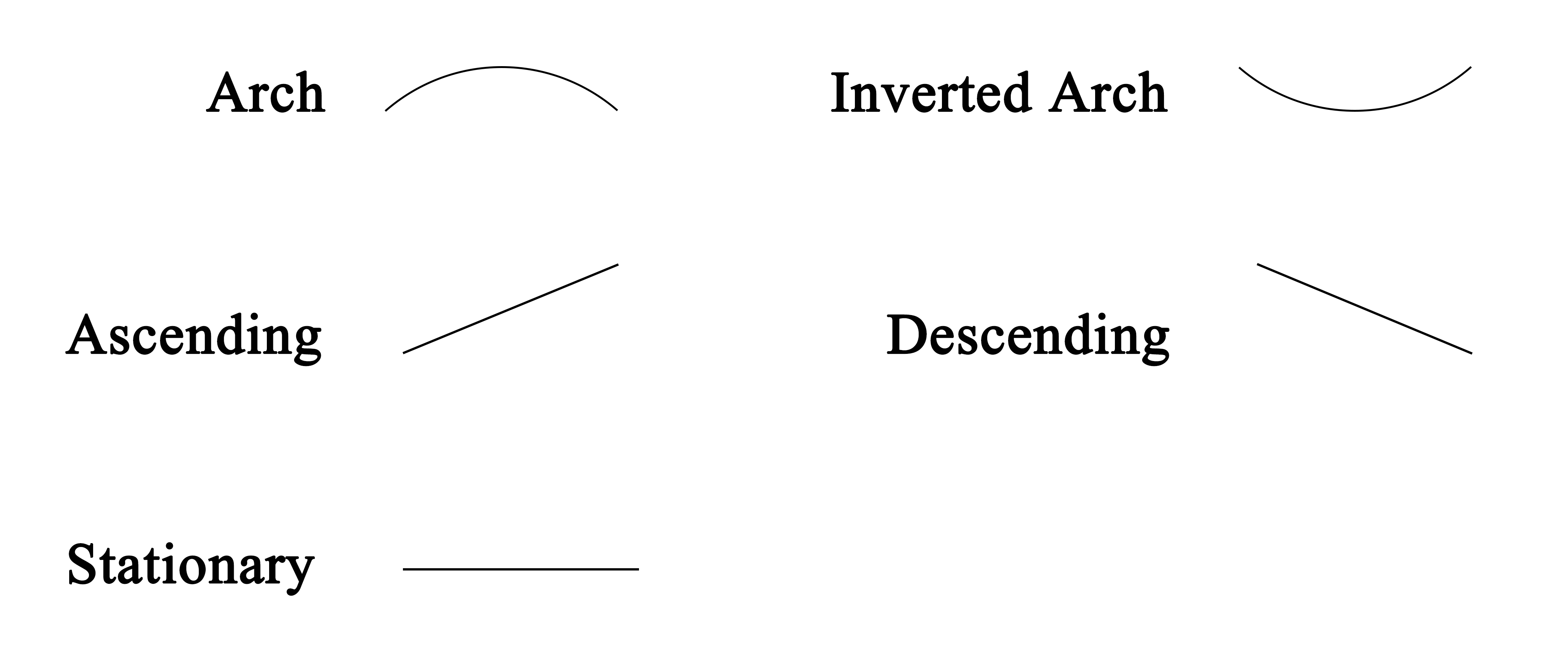 Shapes for arch, inverted arch, ascending, descending, and stationary lines are shown.