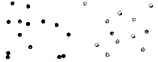 Soybean pollen grains, dark and white grains are contrasted with one another.