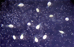 Close-up photo of spores, little white dots on a dark background.