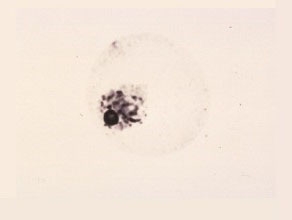 Middle Uninucleate Cell