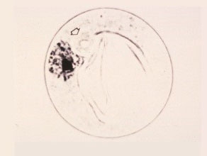 Late Uninucleate Cell
