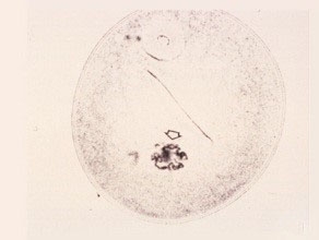 First prophase
