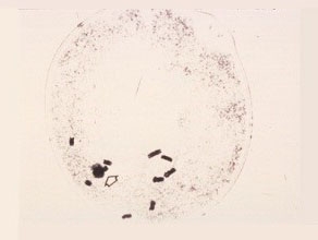 Late First-Prophase
