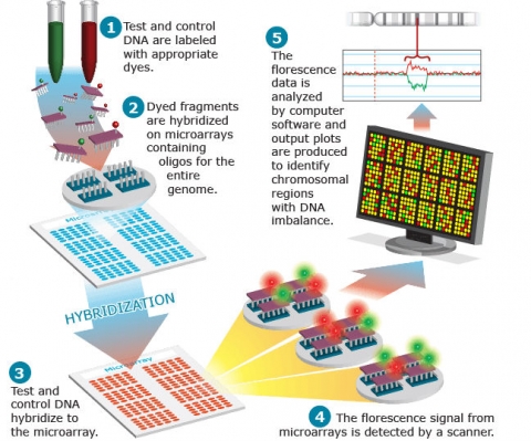 The aCGH process, labeled. Test and control DNA are labeled; dyed fragments are hybridized on micro-arrays; Fluorescence from micro-arrays is detected by a scanner; and that data is analyzed to identify chromosomal regions with DNA imbalance.