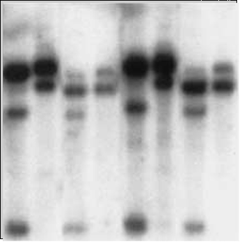 Blot analysis of DNA, a blurry selection of black lines on a neutral background.