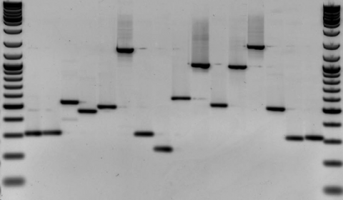 Electrophoresis results, a series of black lines against a neutral background.